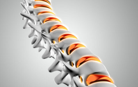 3D spine with discs highlighted