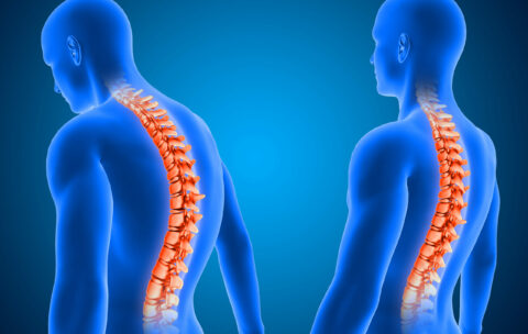 3D medical background showing correct and poor posture with spin
