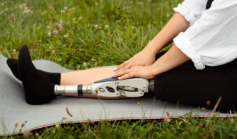 Реабилитация после ампутации