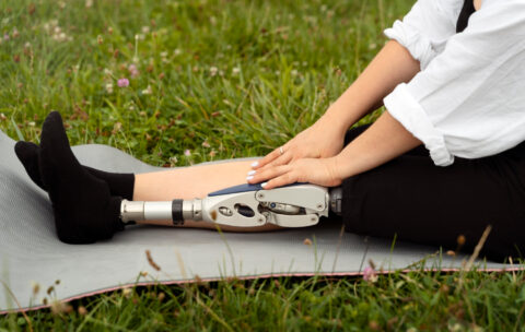 Реабилитация после ампутации